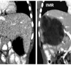 Completed numbers for a dictating radiologist.
