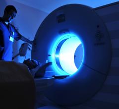 Evaluation of therapeutic efficacy of drug candidates in preclinical oncology with positron emission tomography (PET)