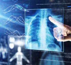 Transforming the Radiology Experience Through Integrated AI 