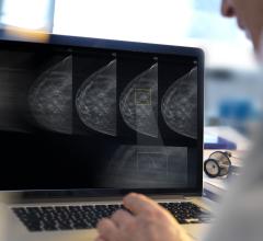 New advancements have the potential to improve early breast cancer detection, but the industry must first overcome the barriers limiting patient access to screening