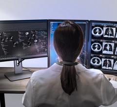 Radiology PACS Systems comparison chart. Picture archiving and communication systems (PACS) are used to route digital medical images and reports.
