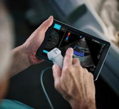 Fujifilm Sonosite took a different route for handheld ultrasound systems with its iViz, used for point of care ultrasound.