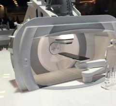 A model of the new, compact, single-room Varian ProBeam 360 system. The system is an example of the trend in proton therapy toward single-room, smaller systems and away from multi-room treatment centers. #ASTRO18 #ASTRO2018