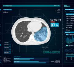 AI vendor Infervision's InferRead CT Pneumonia software uses artificial intelligence-assisted diagnosis tp improve the overall efficiency of the radiology department. It is being delayed in China as a high sensitivity detection aid for novel coronavirus pneumonia (COVID-19). #COVID-19 #COVID19 #Coronavirus #2019-nCoV