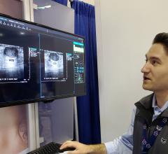 In a demonstration on the exhibit floor of the SBI symposium, Koios software identified suspicious lesions in ultrasound images