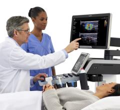 When performing a biopsy procedure, radiologists can feel more confident in their sampling with the assistance of shear wave elastography. 