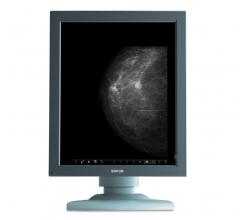 Mammography Women's Health ACR SBI NEJM Article