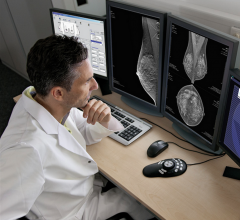 About 25 percent of screening patients and 60 percent of diagnostic patients do not have prior mammograms available for comparison at the time of their examinations due to the lack of interoperability or other restrictions preventing clinicians from accessing prior exams.