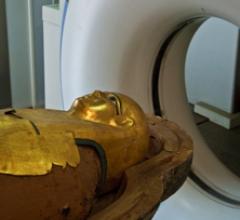 Mummies Egypt Atherosclerosis CT Systems