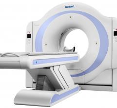 The NeuViz 16 Essence from Neusoft Medical Systems.