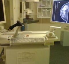 Mammography: The Film-to-Digital Crossover