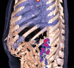 Nuclear Medicine is the New Personalized Medicine