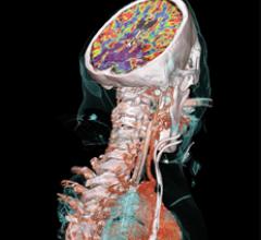  PET CT Siemens supplied Neuro VPCT ASplus