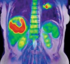 The Potential of PET/MR