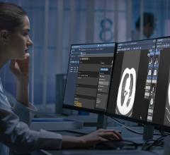 From PACS to Enterprise Imaging