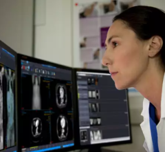 Enterprise imaging vendors are releasing completely new, revamped platforms that are programmed from the ground up as web-based platforms, rather than older architecture systems that were modified to be used as cloud-based systems