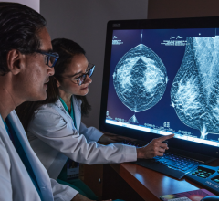 Through DBT, medical technology has been able to pave a new path and provide a launch board for AI and other technologies that can use its high-resolution images