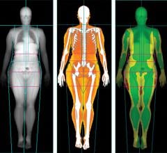 Body scans, Lunar iDXA