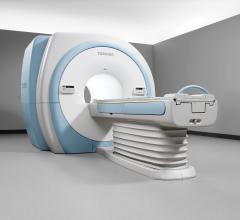 MRI Technology and Throughput