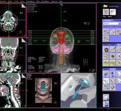 Treatment Planning systems, RT planning software