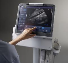 2013 Ultrasound Market Report Klein Biomedical Consultants Inc.