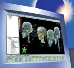 Treatment Plans: Precision in Quick Time