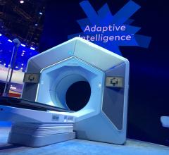 Varian received FDA clearance for its Ethos therapy in February 2020. It is an adaptive intelligence solution that uses onboard AI in the treatment system to take the cone beam CT imaging on the system, compare it to the treatment plan and deliver an entire adaptive treatment plan in a typical 15-minute treatment time slot, from patient setup through treatment delivery.
