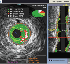 Volcano, Philips, acquisition, FFR, IVUS