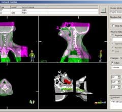 treatment planning system, elekta, aapm