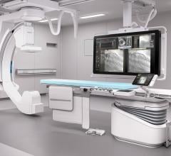 Philips provides the Allura Xper and AlluraClarity angiography imaging systems with ClarityIQ technologies