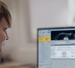 Philips' ScanWise software automatically sets MRI protocols based on MR-conditional implantable devices the patients has