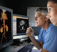 Cardiologists using the Philips spectral CT software to view a spectral CT image reconstruction at various energy levels.