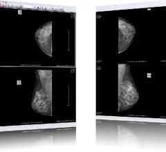 PACS upgrade, 11 questions, RamSoft, Al Kappel, RSNA 2016