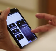 Samsung Tablet-based Ultrasound Trial Shows Lifesaving Potential in Emergency Services