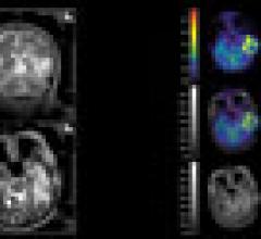 PET/MRI: The Modality of Choice? 