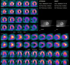 Moving Awareness to Action in Nuclear Medicine Dose