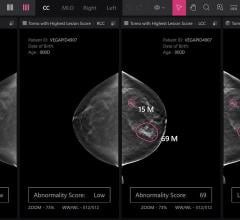Lunit Insight DBT Revealing the Hidden Threat: How AI is Changing the Story of Interval Breast Cancers