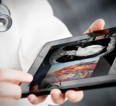 remote viewing systems allow mobile access for radiology imaging