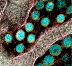 Transmission electron micrograph of SARS-CoV-2 virus particles, isolated from a patient. Image captured and color-enhanced at the NIAID Integrated Research Facility (IRF) in Fort Detrick, Maryland. Image courtesy of NIAID