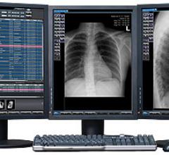How to pick a teleradiology company.