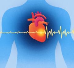 MRI, cardiac imaging, AI