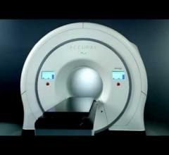 Accuray TomoHD System Centre Oscar Lambret Lille France.