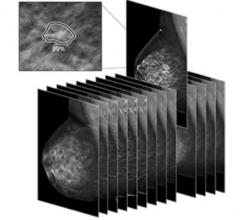 iCAD's ProFound AI Wins Best New Radiology Solution in 2019 MedTech Breakthrough Awards