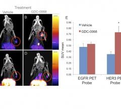 PET probes, breast cancer, surface receptor changes, MGH study, Memorial Sloan Kettering