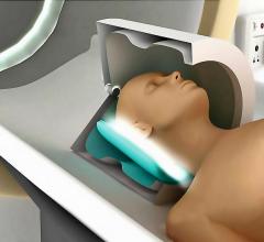 New Metamaterial-Enhanced MRI Technique Tested on Humans