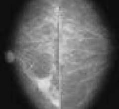 MRI-Guided Biopsies