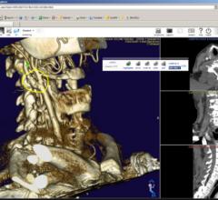 Nil 4.0, PACS 3.0, Claron Technology, remote viewing systems, RSNA 2014