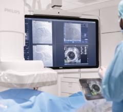 Philips Enters Agreement to Acquire SpectraWAVE