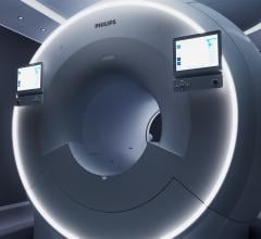 MR 7700 imaging system features an enhanced gradient system for unmatched performance and precision, delivering Philips’ highest image quality to help improve diagnostic outcomes