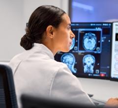 Philips and Cortechs.ai Extend Partnership